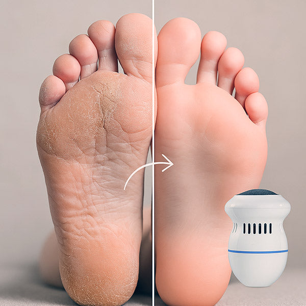 Lime électrique pour les pieds | PediPro